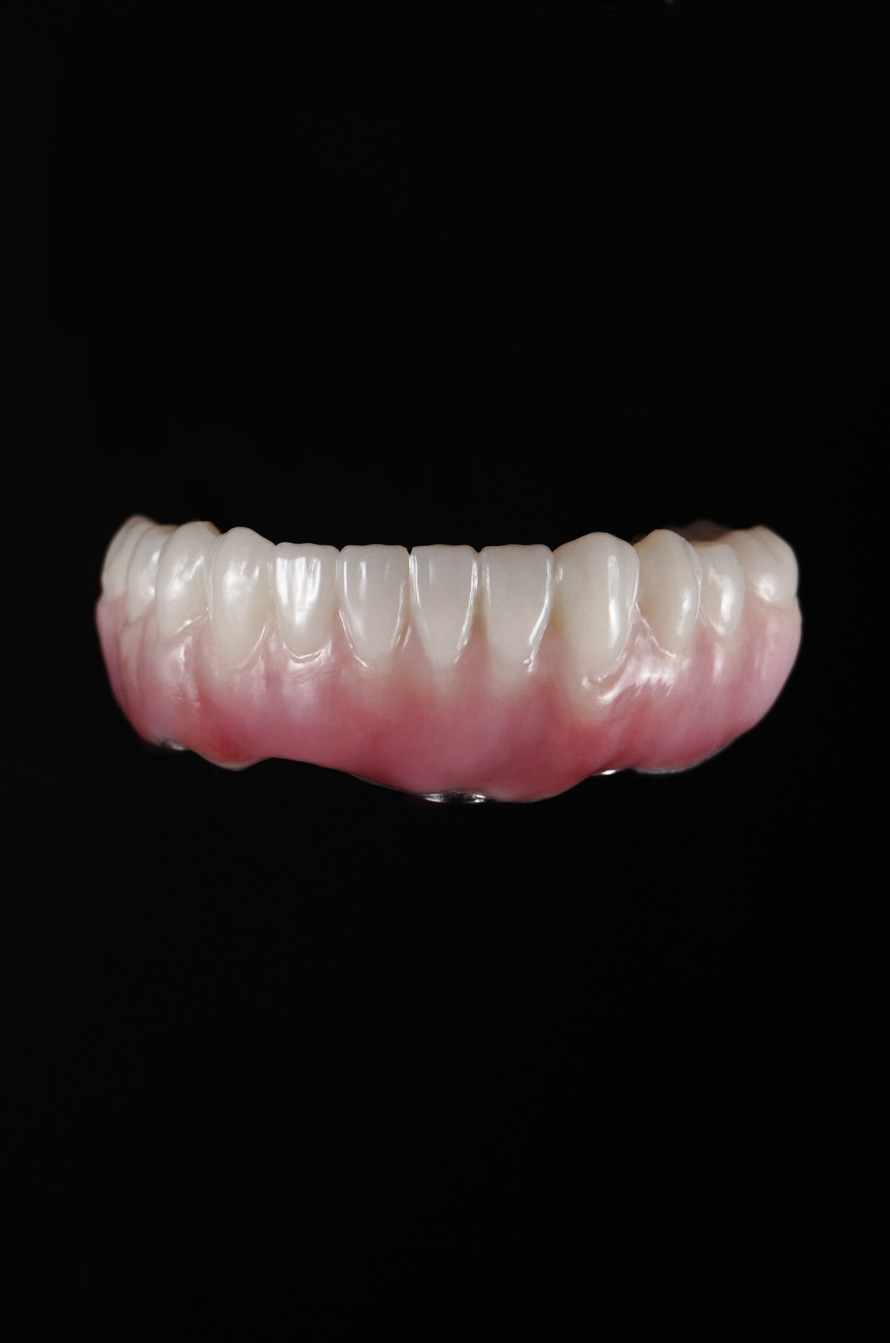 Provisional to Final AOX prosthesis with pink work